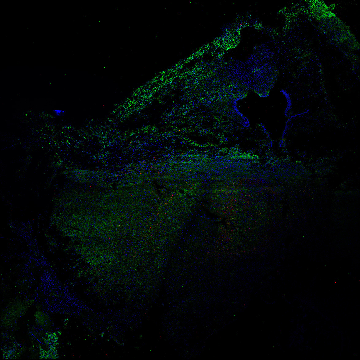 Human foetal midbrain